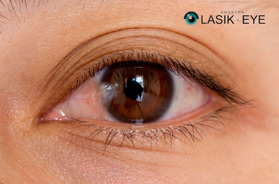 Recovering from Pterygium Surgery: What to Expect Recovering from Pterygium Surgery: What to Expect