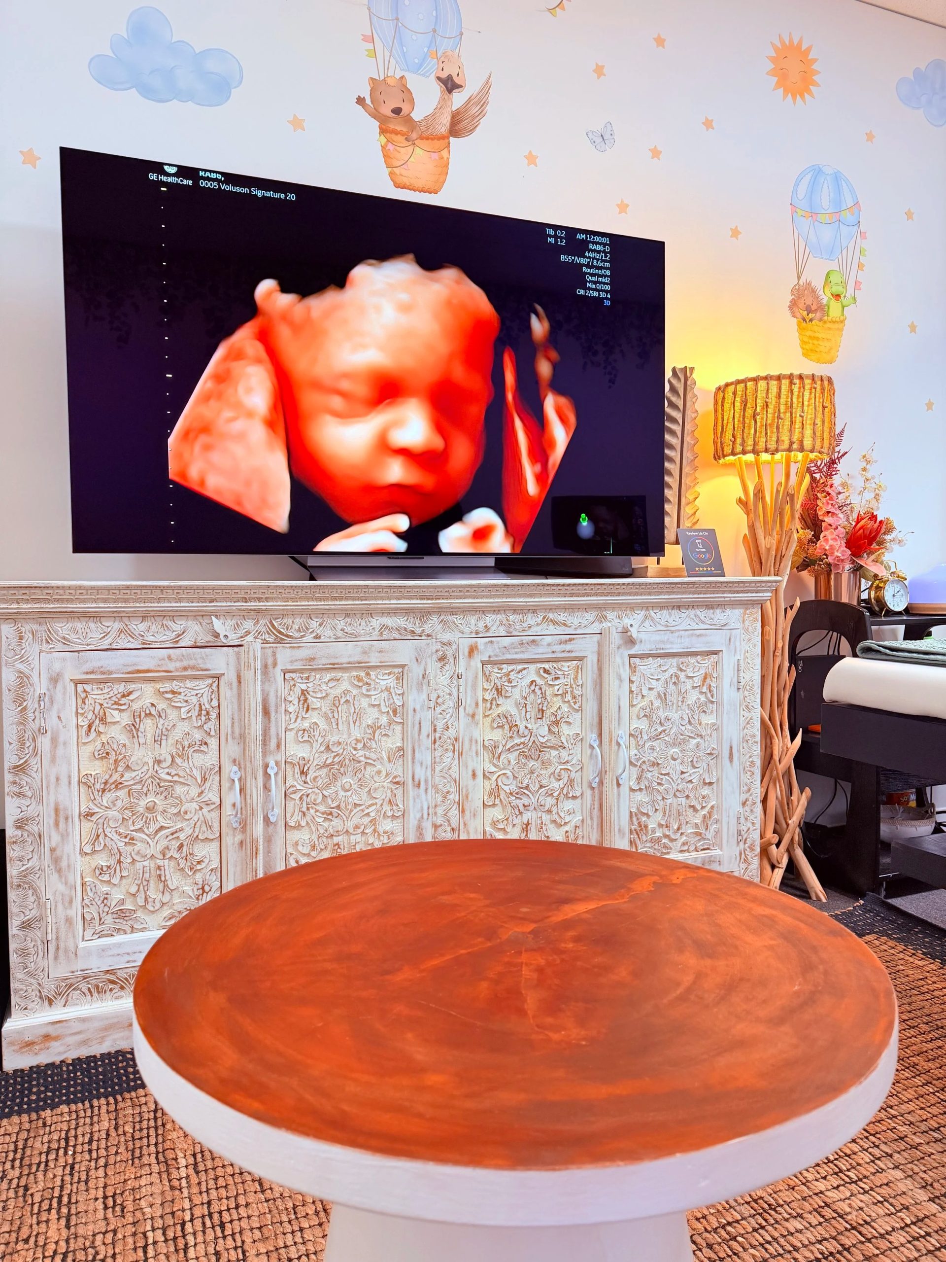 Discover a Trusted Baby Ultrasound Studio in Perth Discover a Trusted Baby Ultrasound Studio in Perth