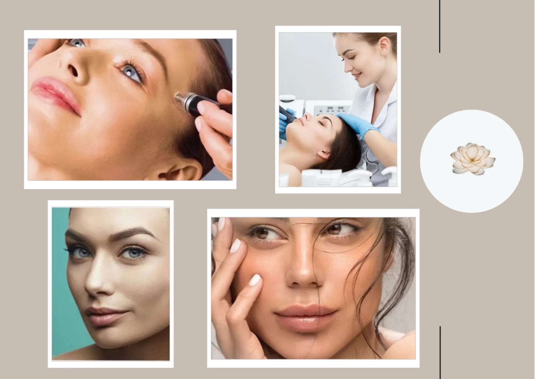 Discover the Transformative Benefits of Fractional Laser Skin Resurfacing at Lotus @ Queensway Medical Discover the Transformative Benefits of Fractional Laser Skin Resurfacing at Lotus @ Queensway Medical